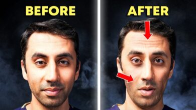 Ozempic Face Photos